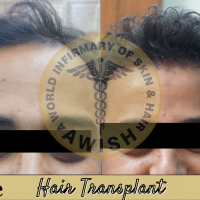 AWISH Skin Care Clinic, Dr. Vijay kumar